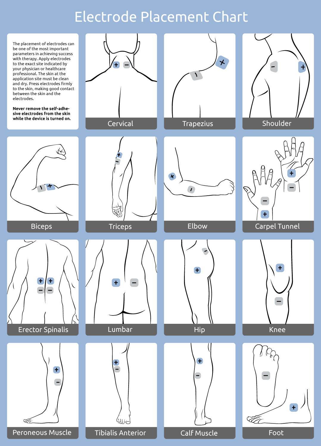 Nmes Electrode Placement Chart